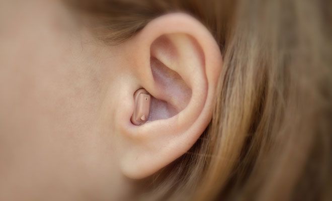 Im-Ohr-Hörgerät